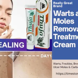 Thuja warts removal cream